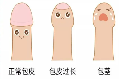包茎对比