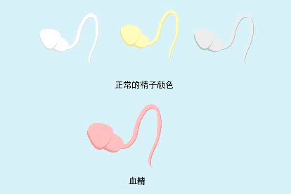 严重血精症的图片