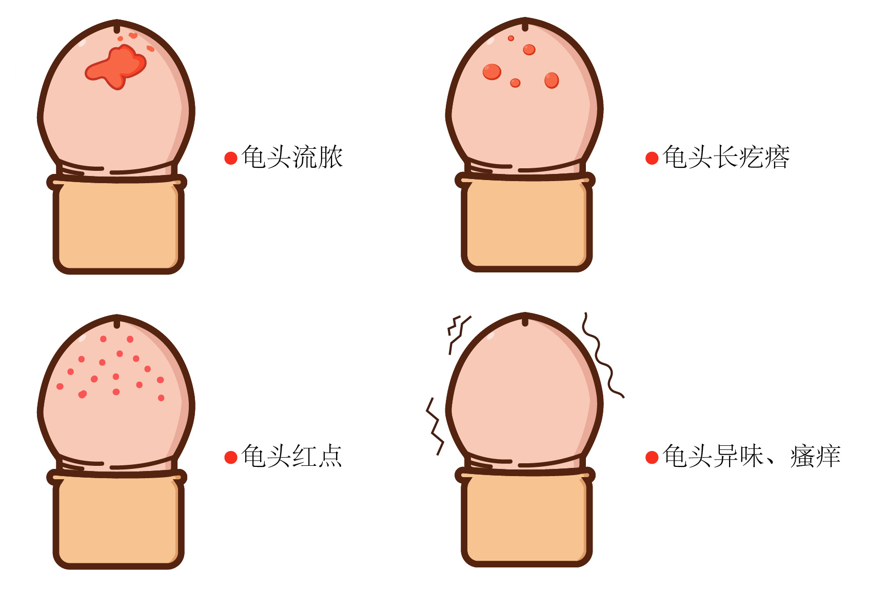 包皮炎图片及症状