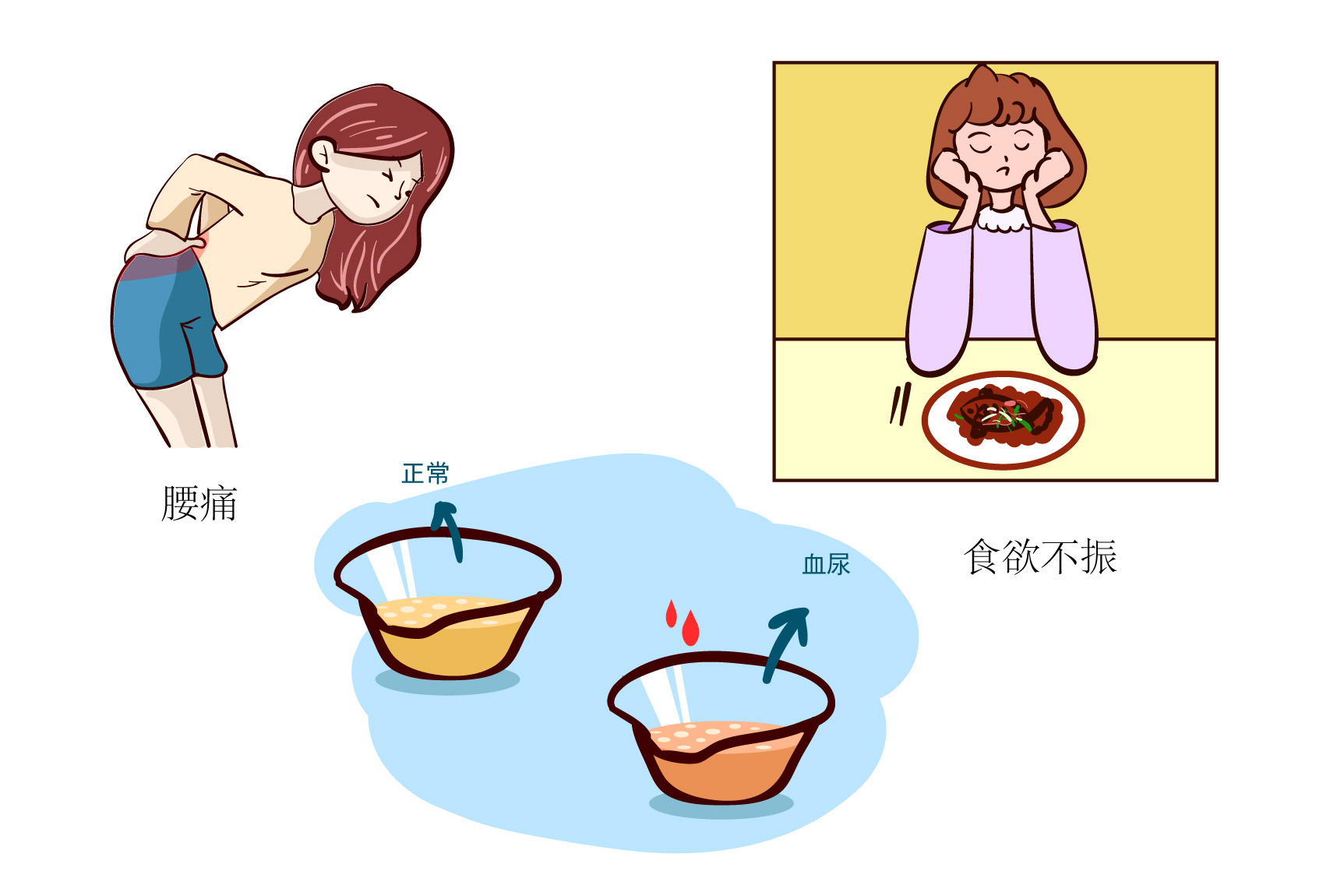 肾盂癌的早期症状图片