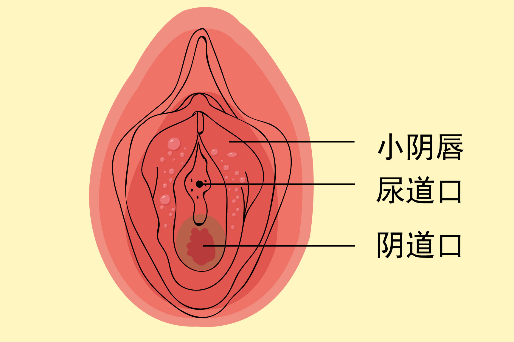 小阴唇纤维瘤图片