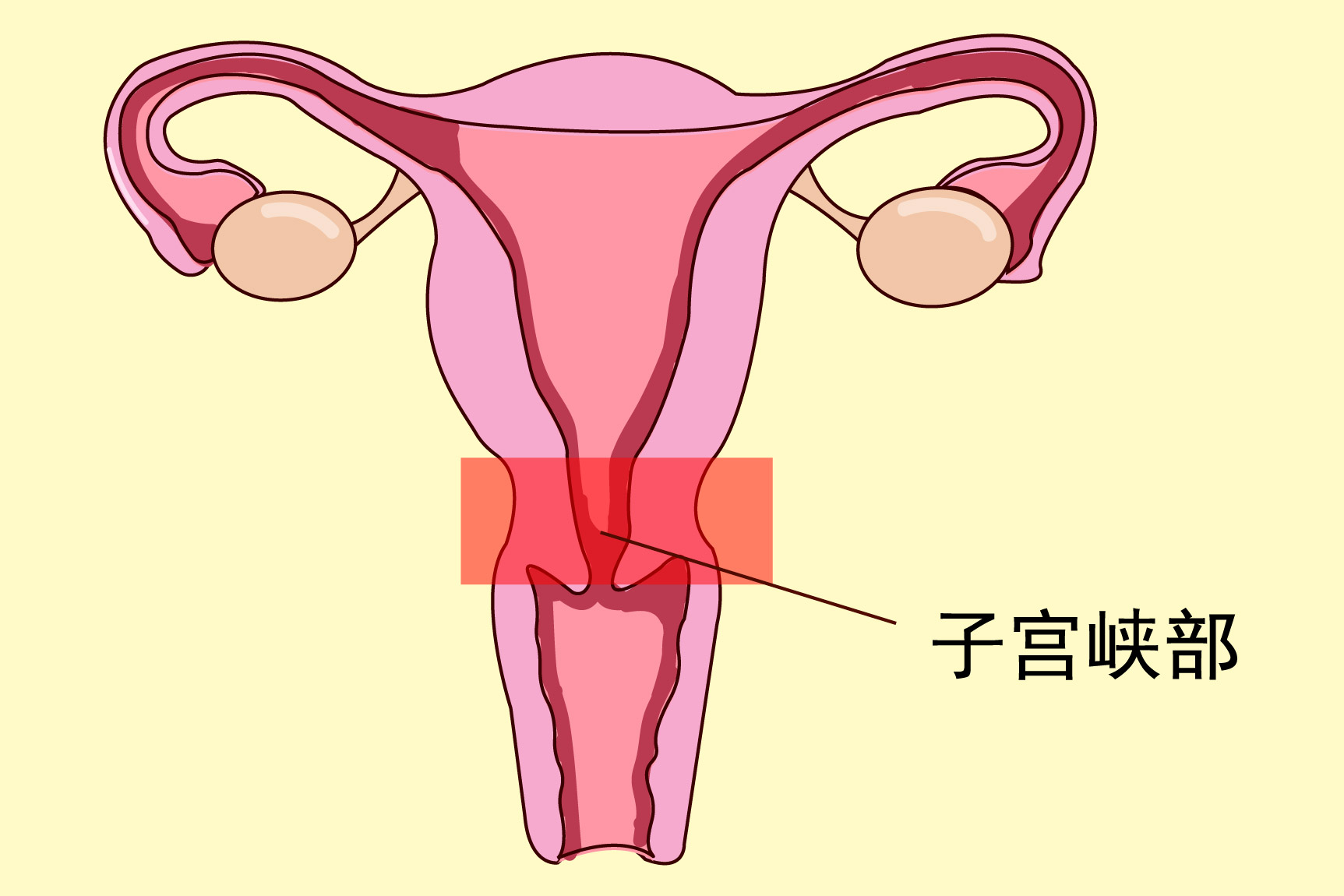 子宫峡部图片