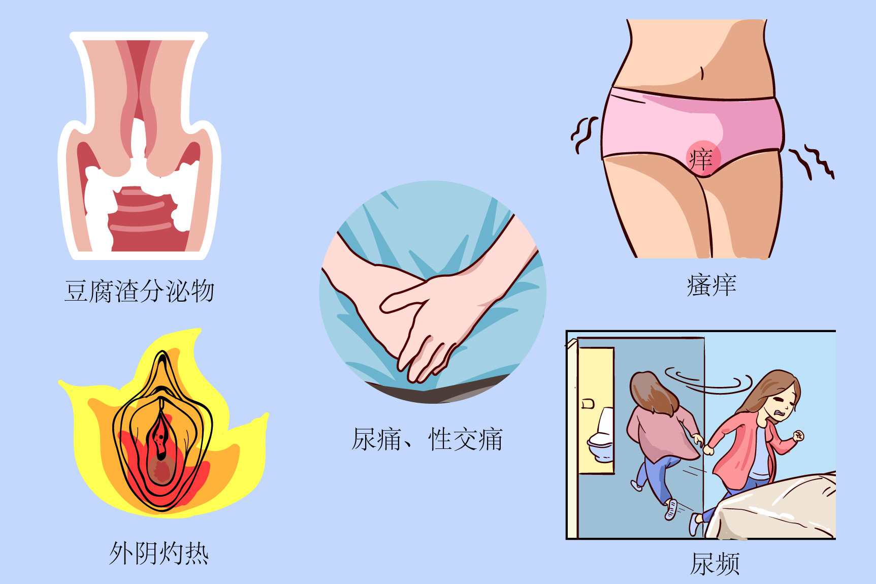 阴道炎图片