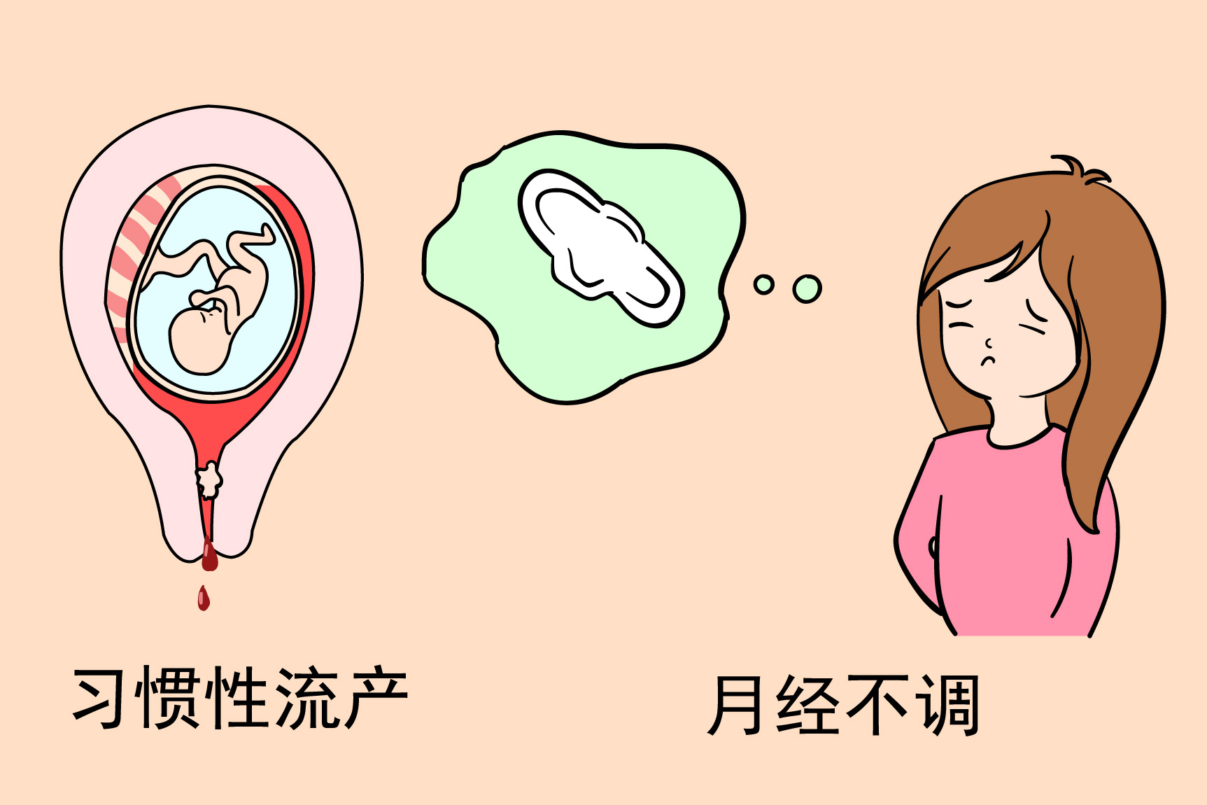宫颈发育不良图片