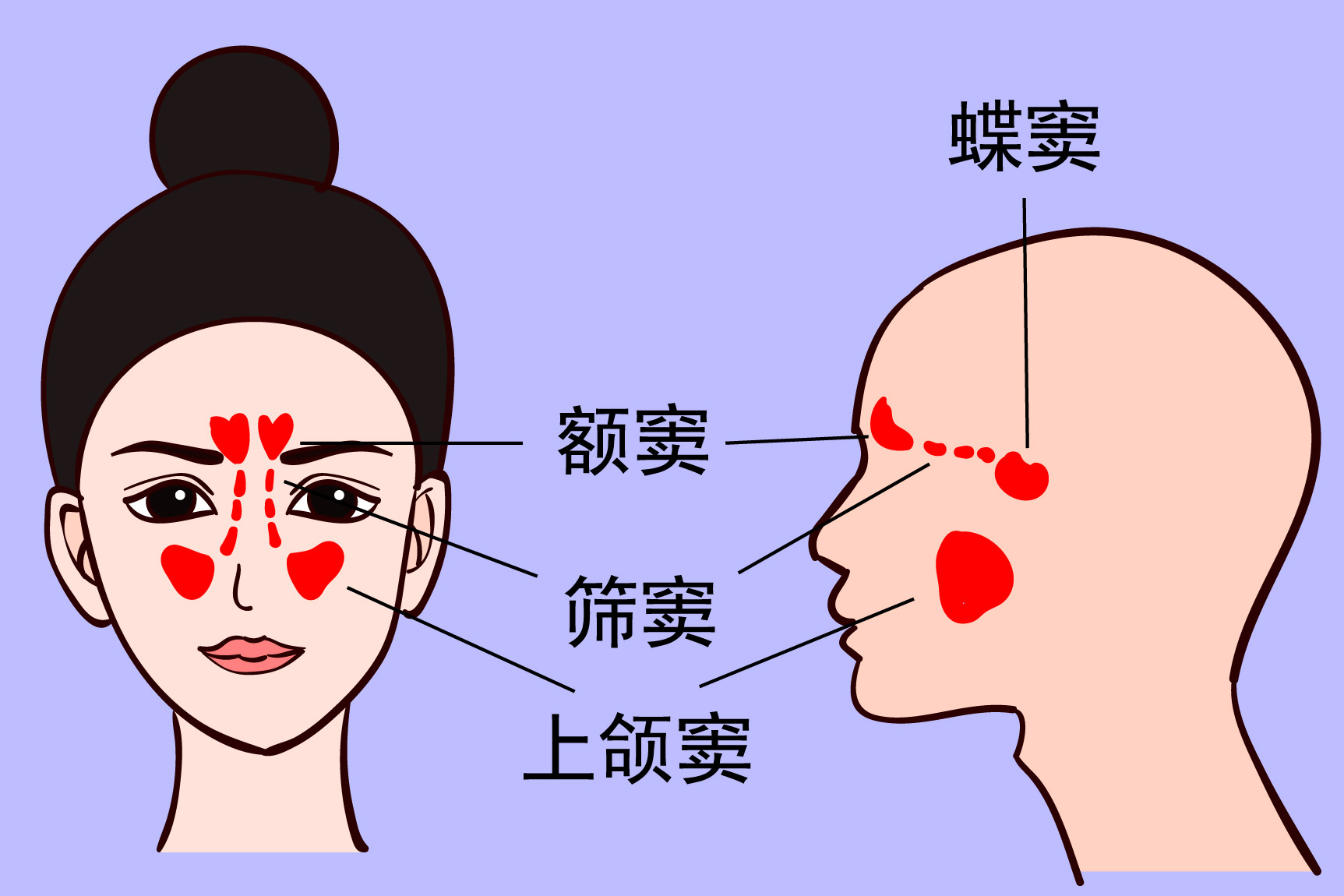 上颌窦位置图片