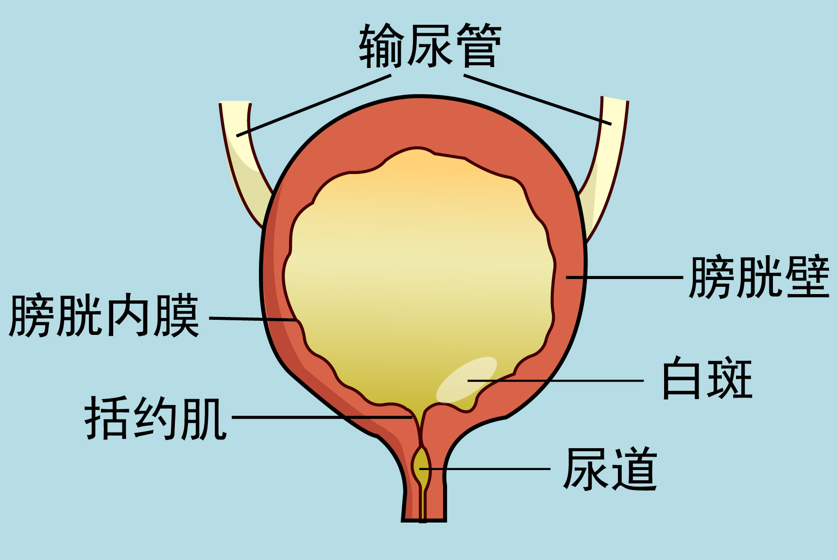 膀胱白斑的图片