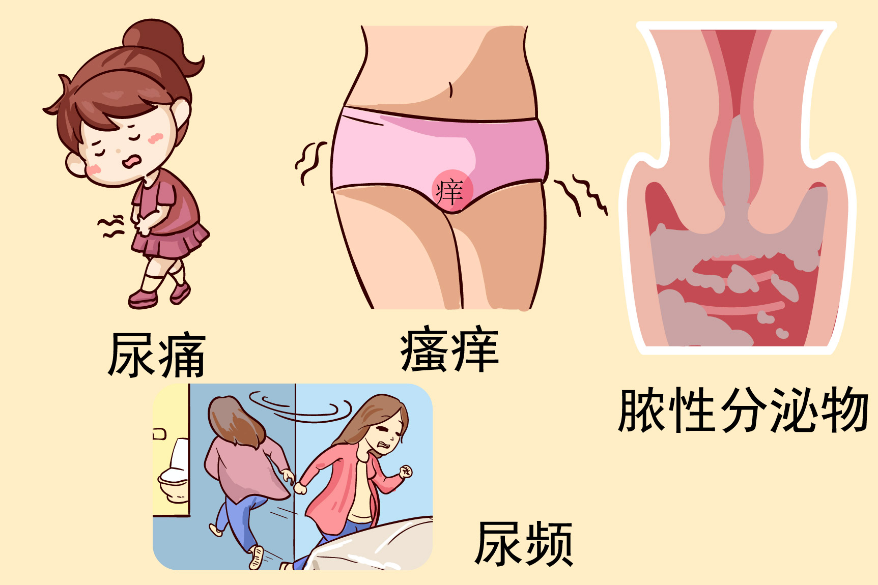 淋球尿道炎图片