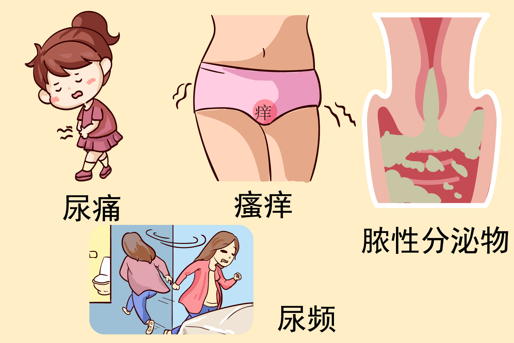 淋菌性尿道炎图片