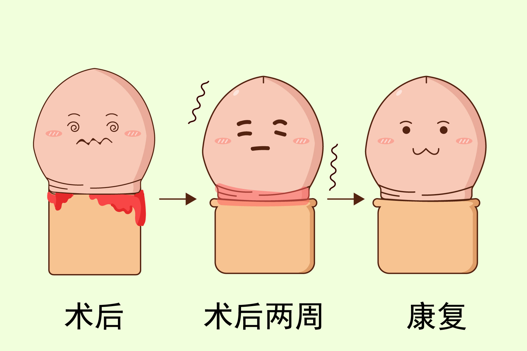 包皮术后两周图片