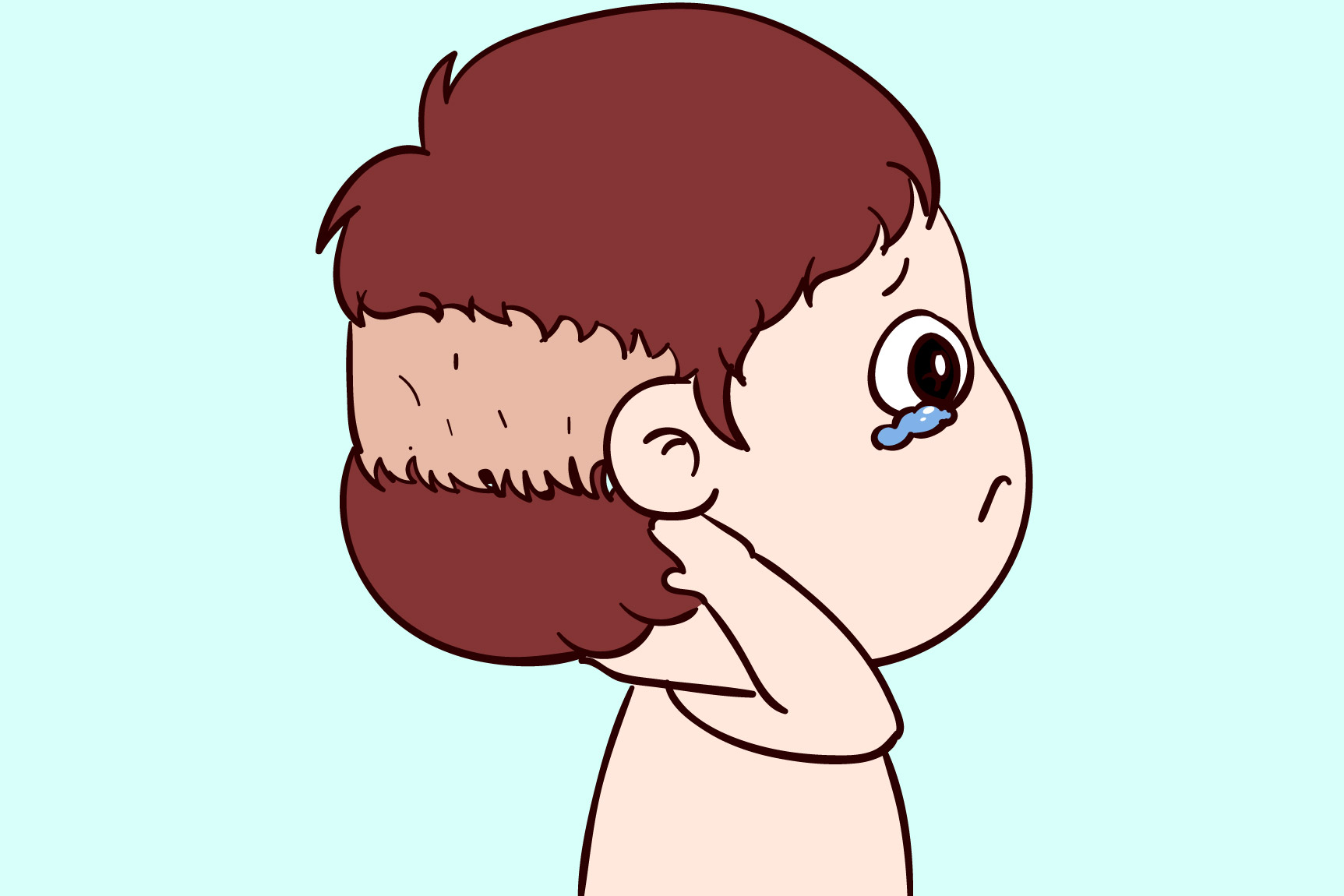 枕秃的症状图片