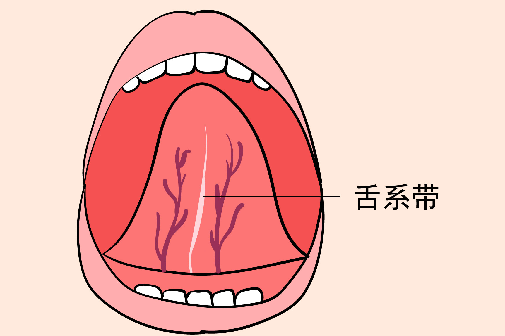 舌头下面发紫图片