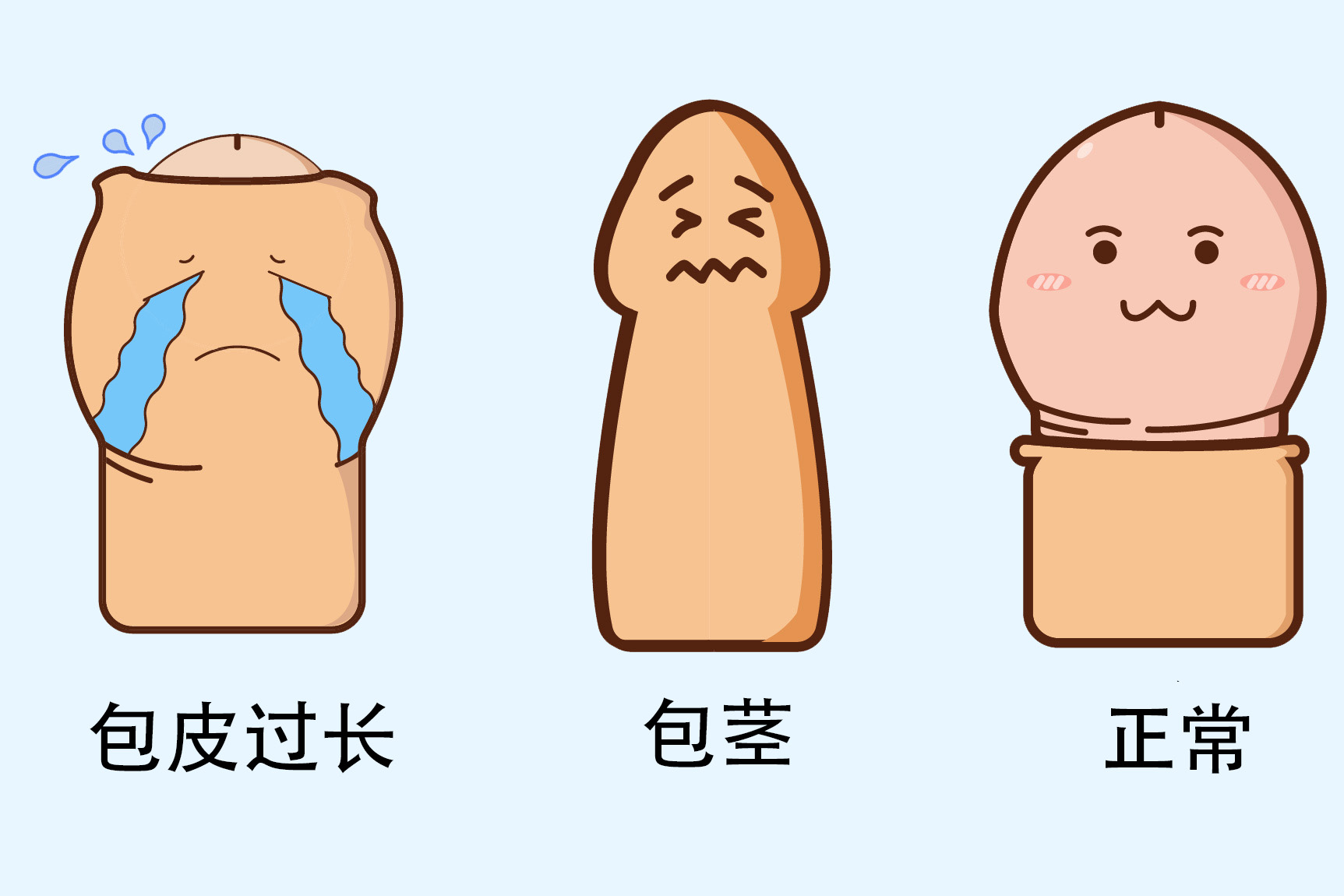 包皮过长图片