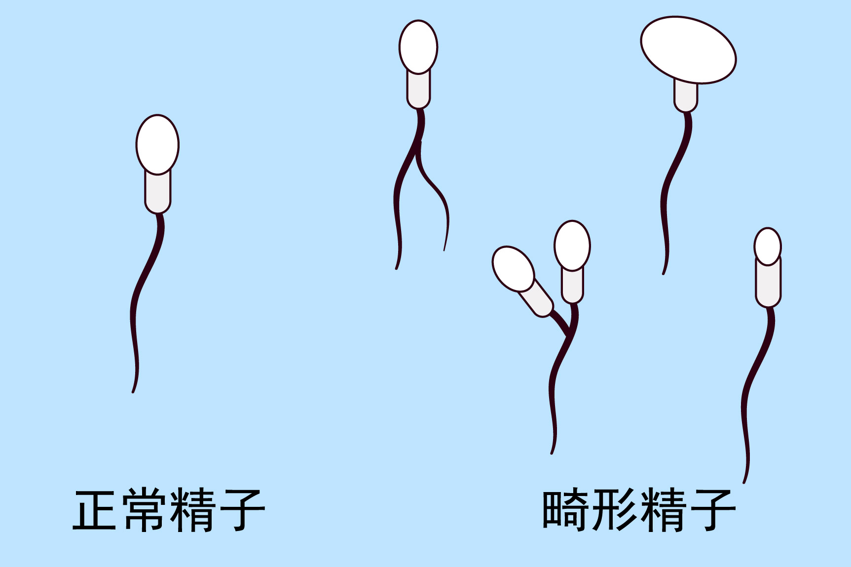 畸形精子图片