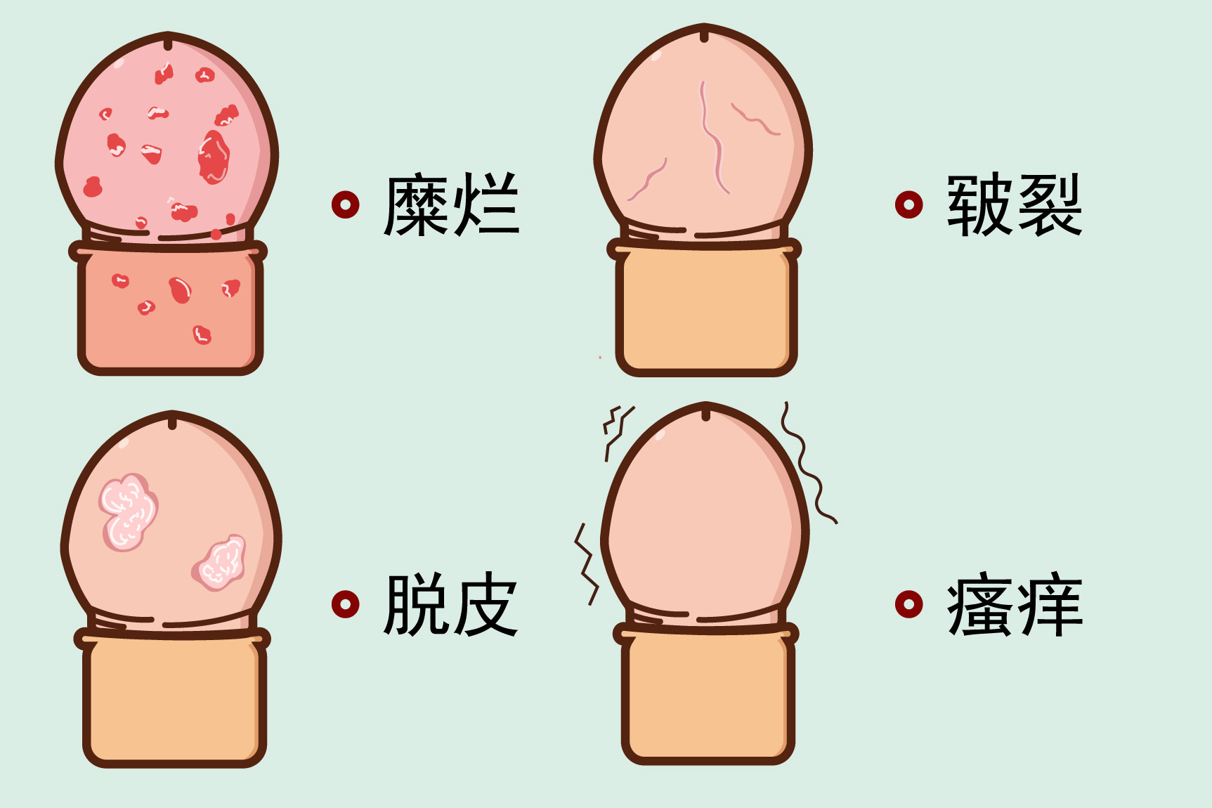 念珠菌性包皮龟头炎图片