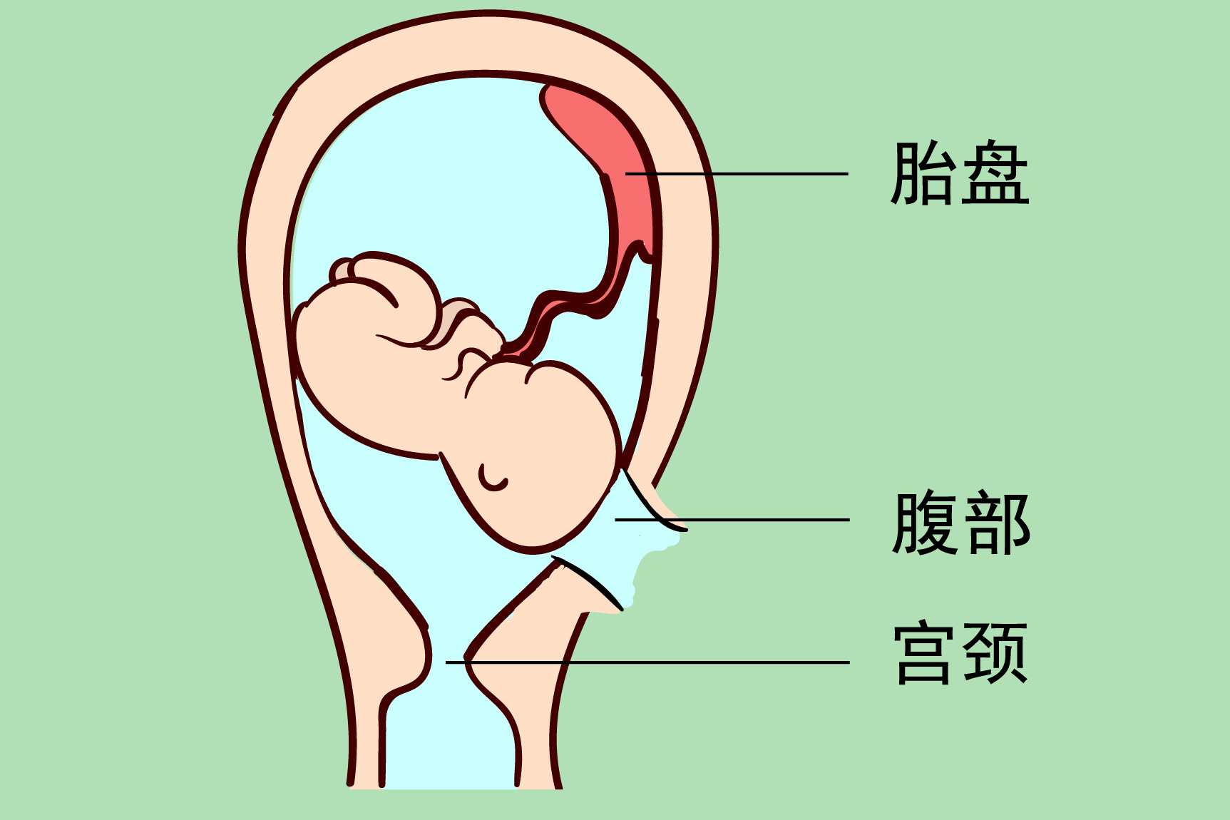 剖腹产图片