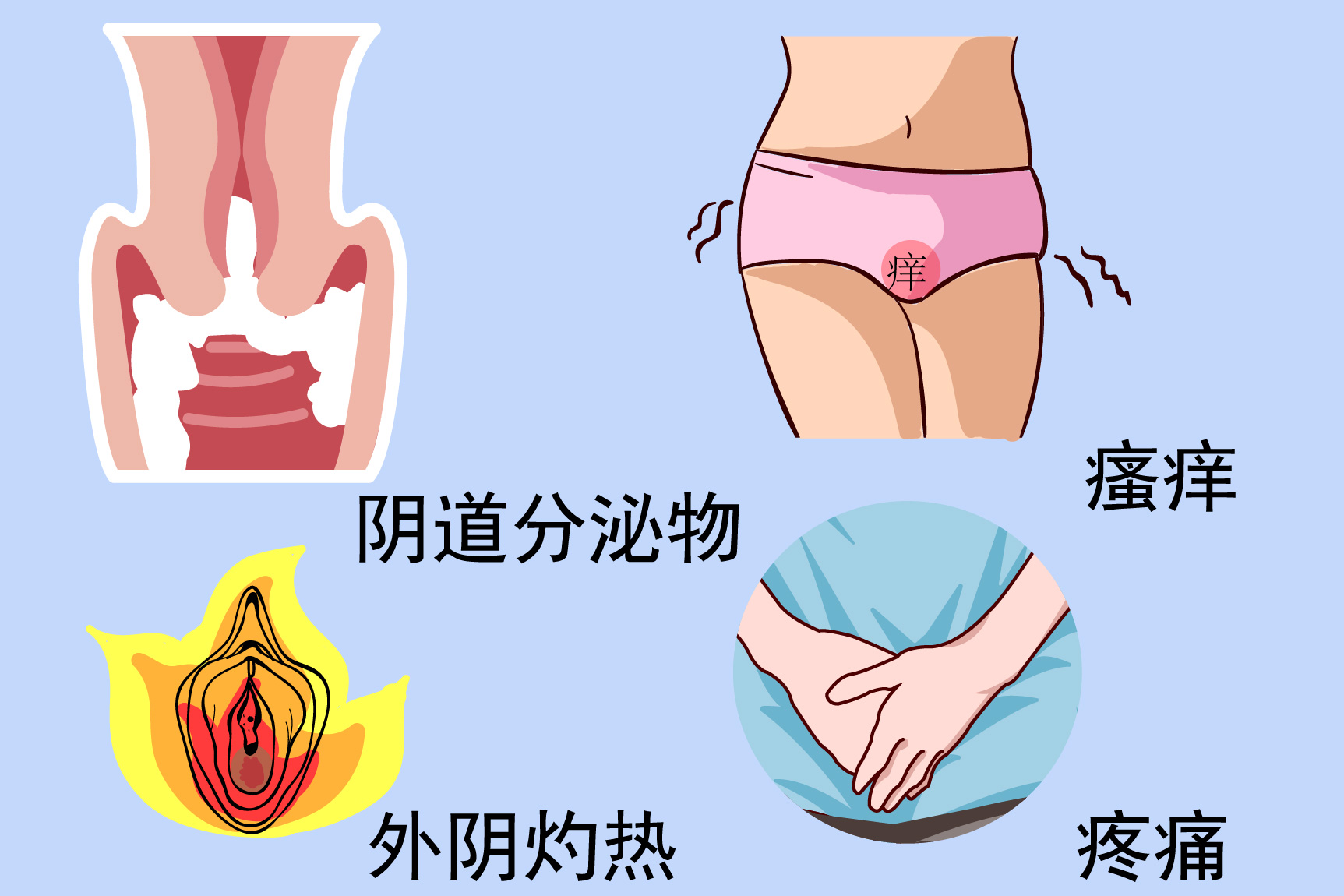 外阴炎症状图片