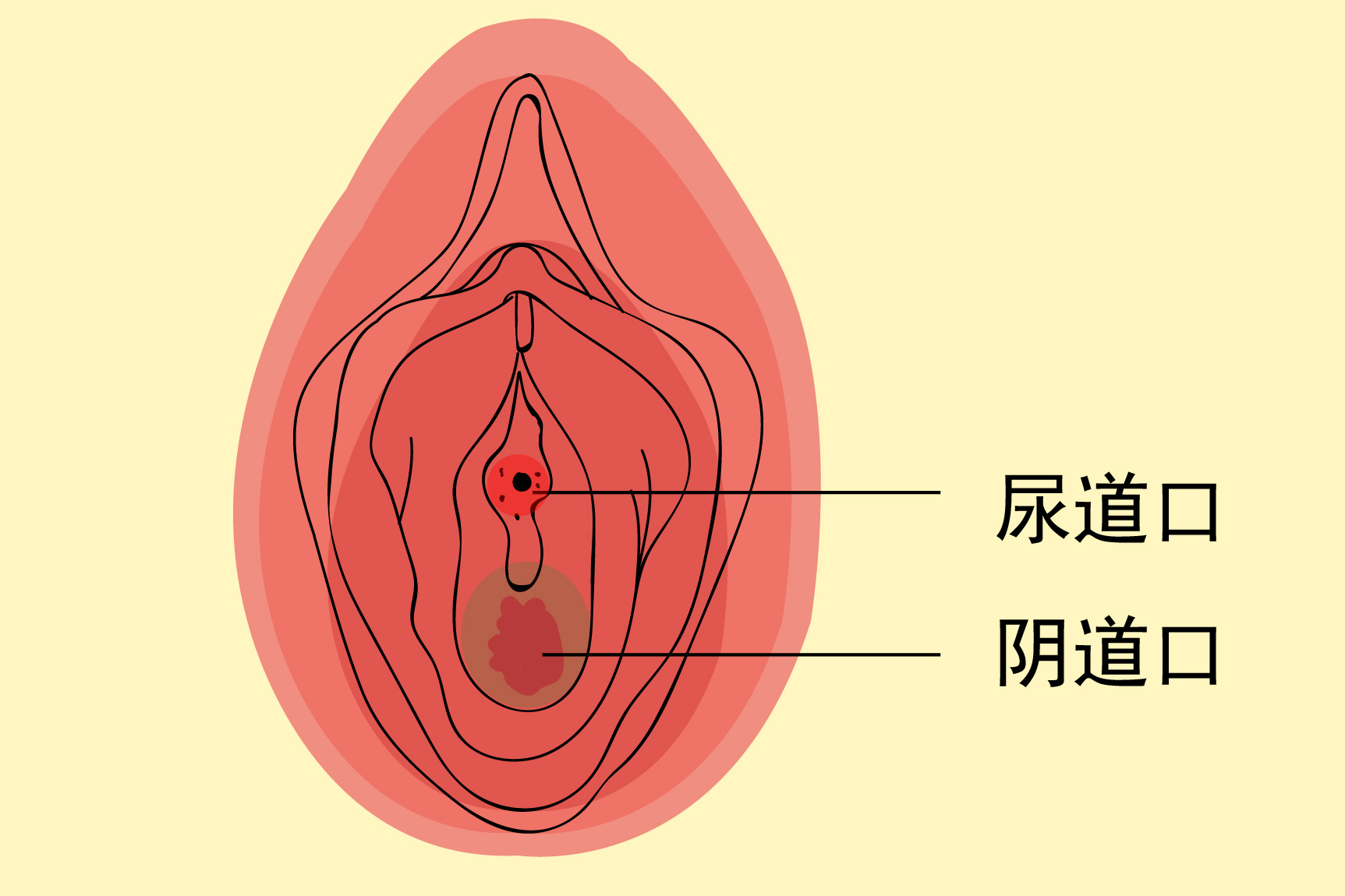 尿道口红肿图片