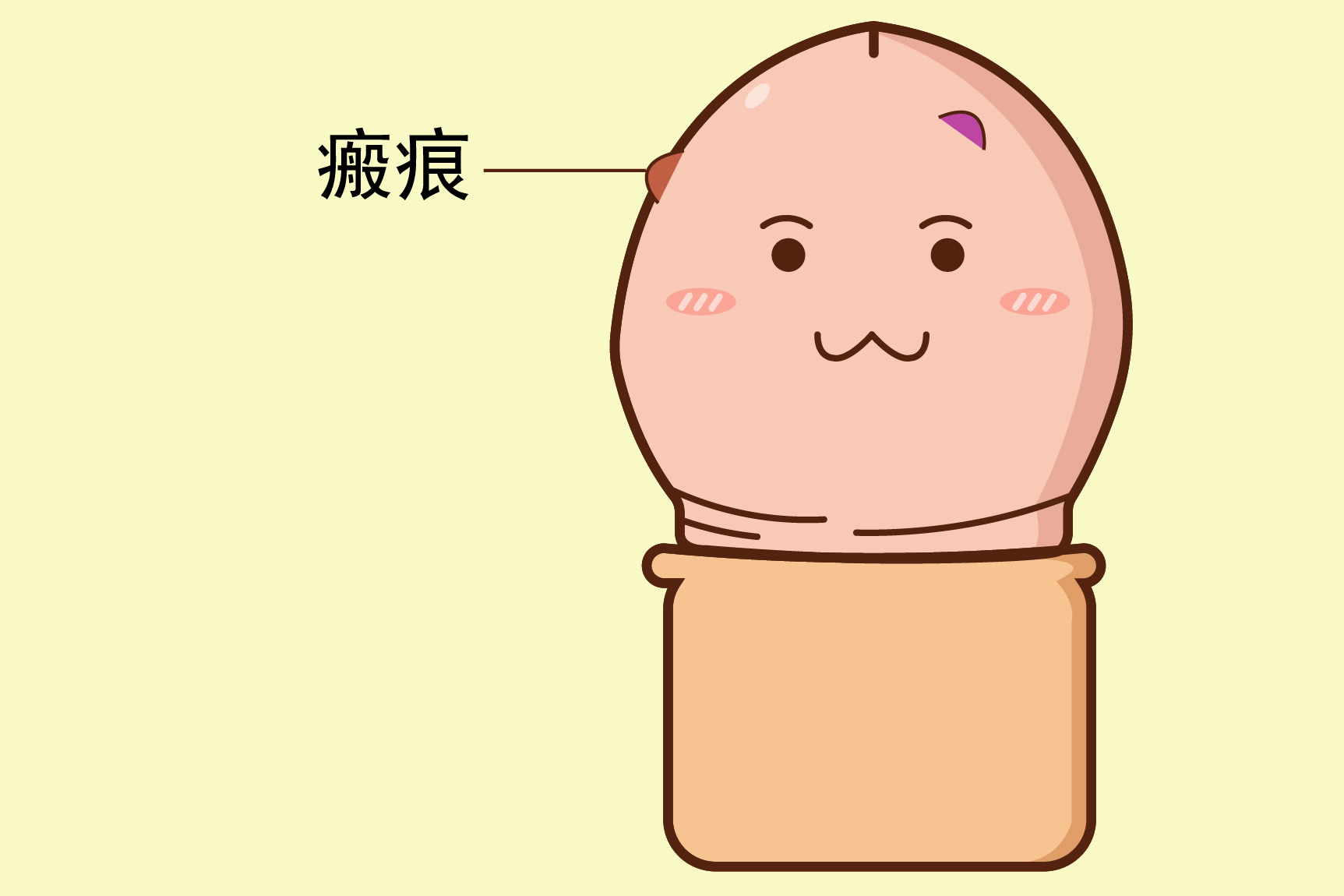 龟头瘢痕图