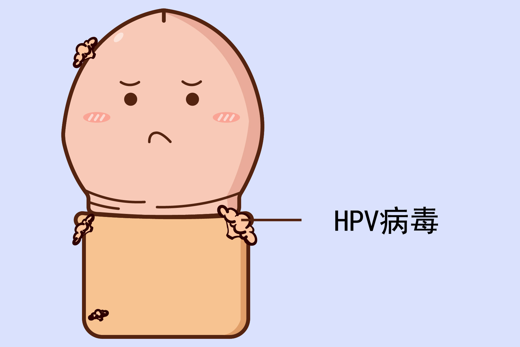 包皮感染hpv图片