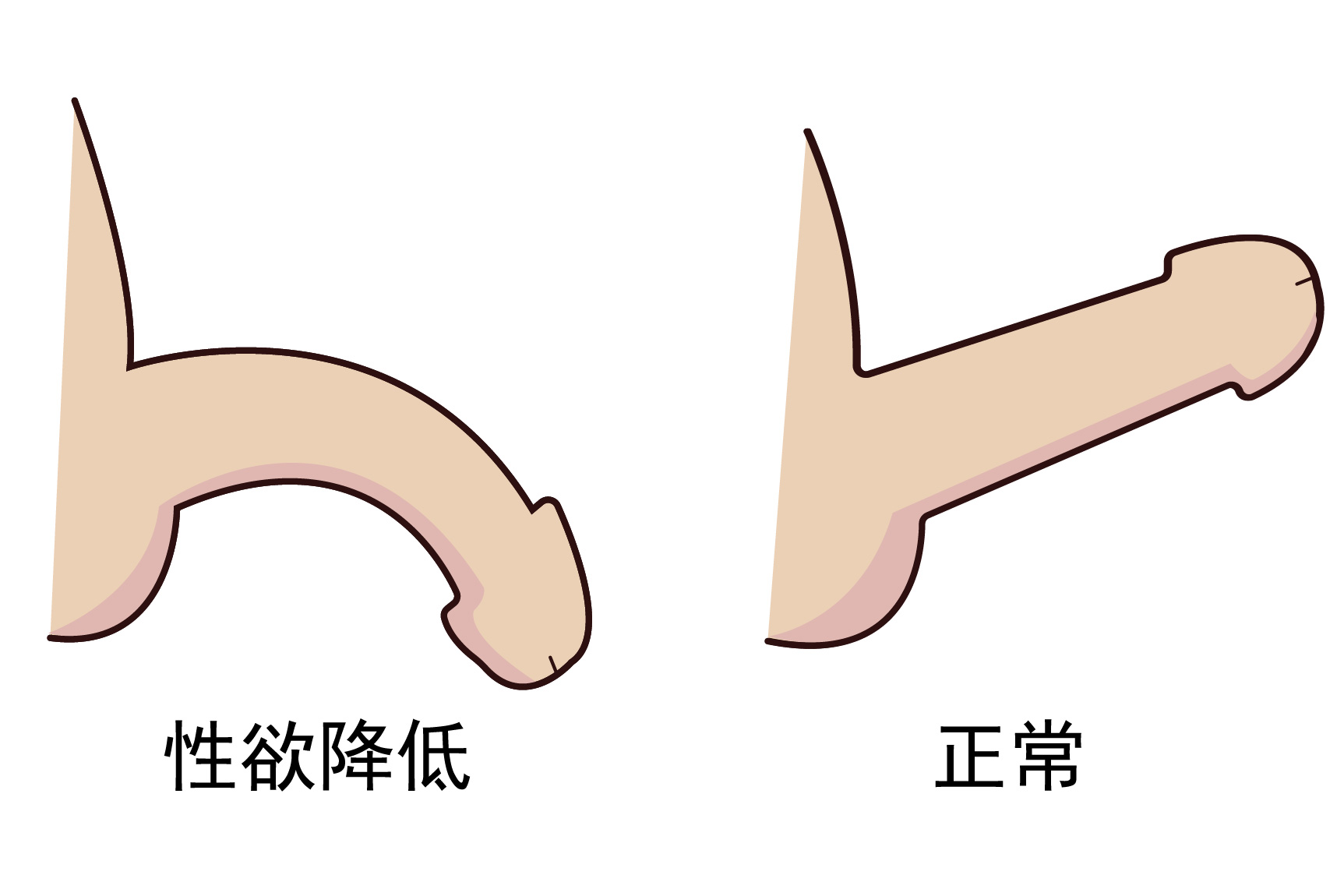 性欲降低图