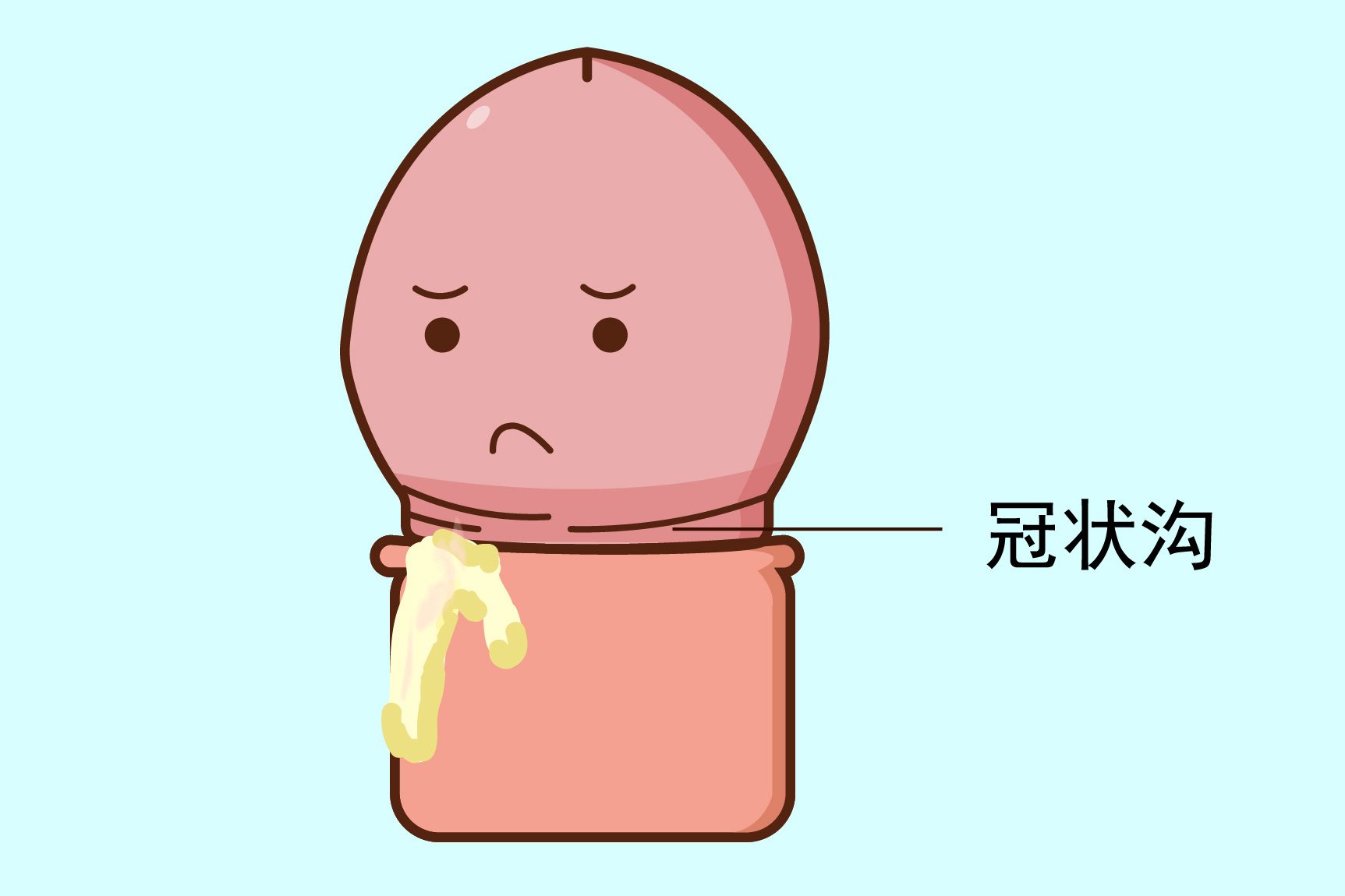 冠状沟发炎图