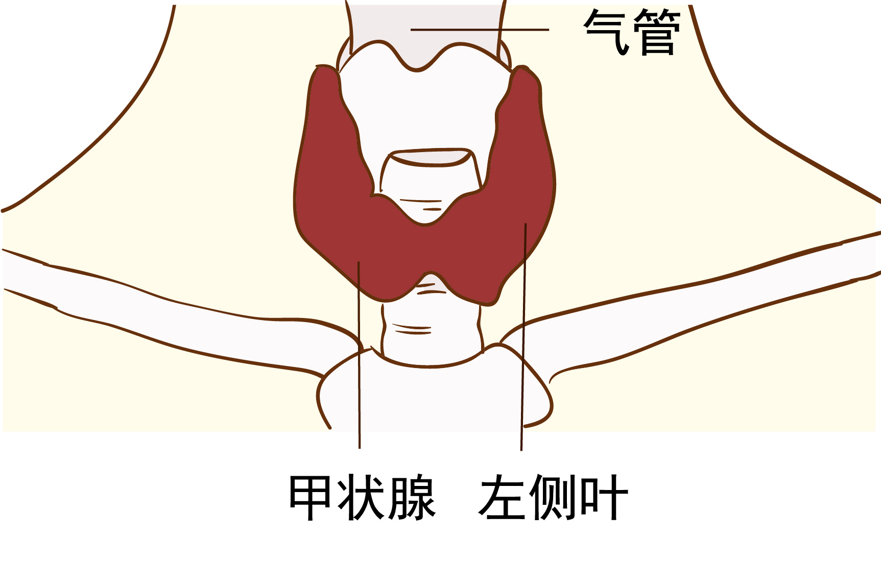 甲状腺左侧叶图