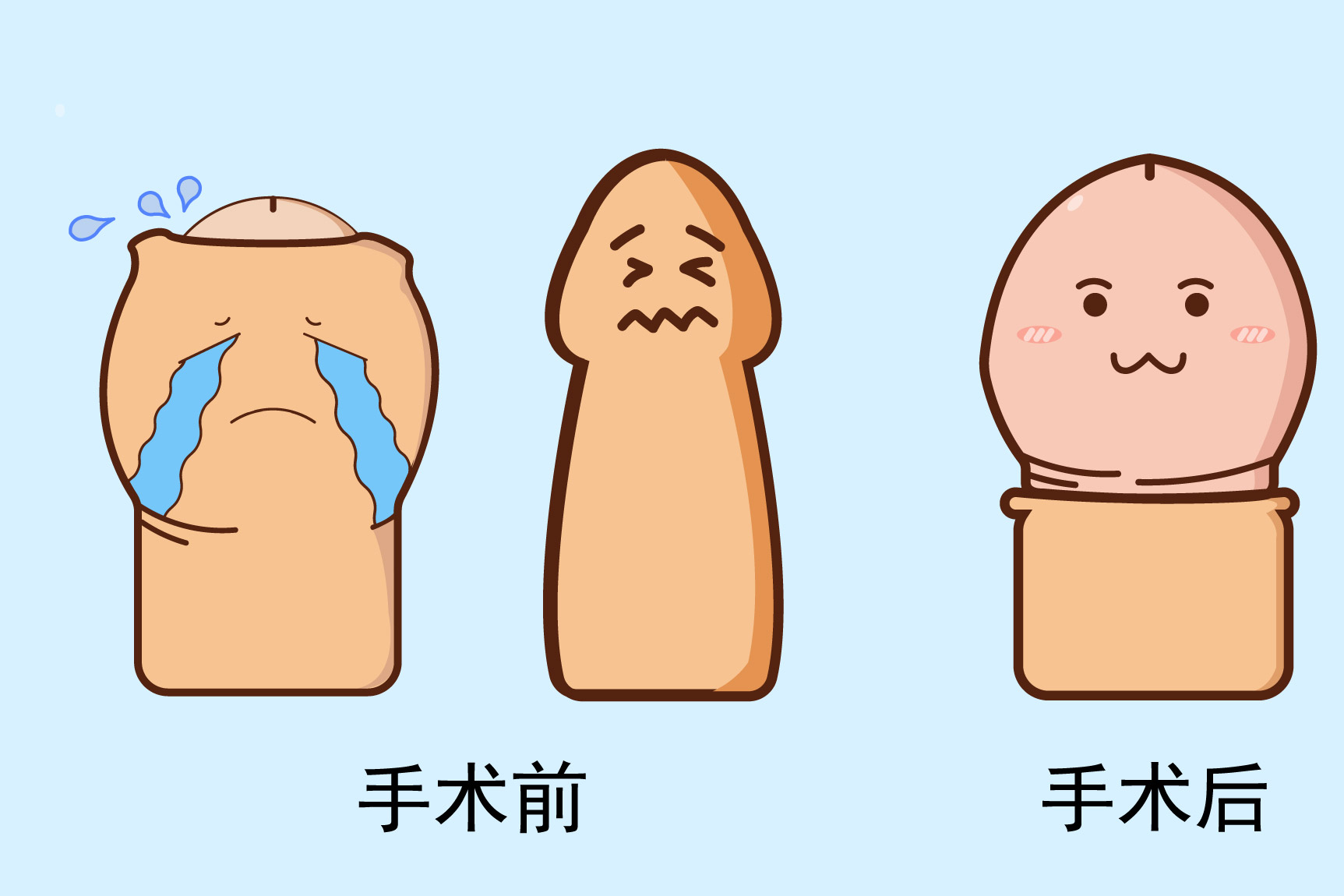 阴茎整形图片