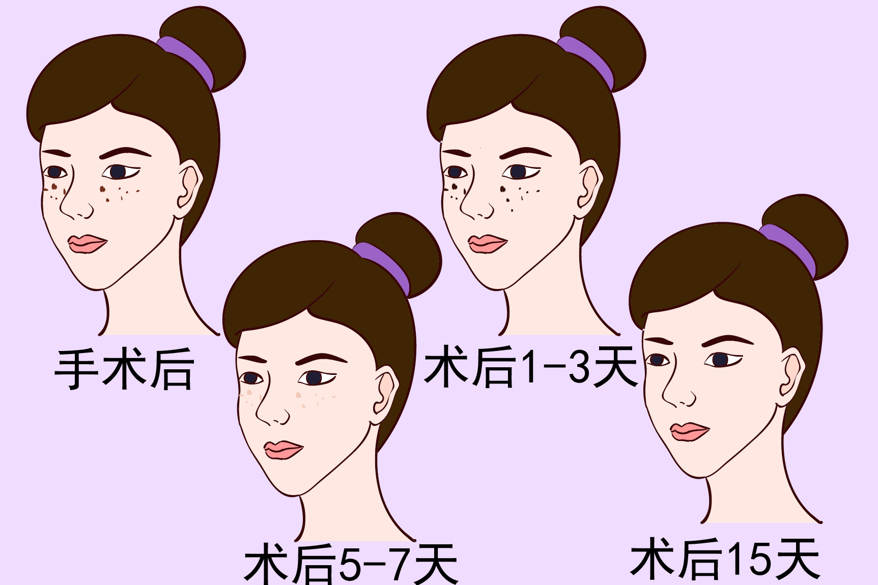 痘印消失的过程图