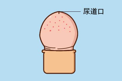 尿道口有红点图片