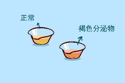 有褐色分泌物图片