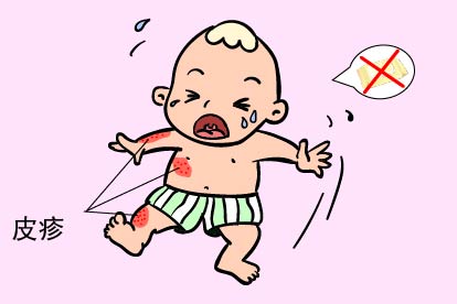 过敏的症状图片