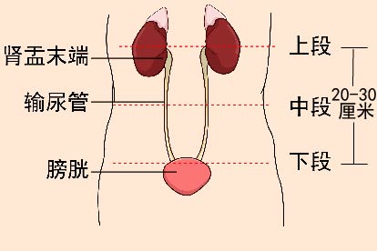 输尿管上段图片