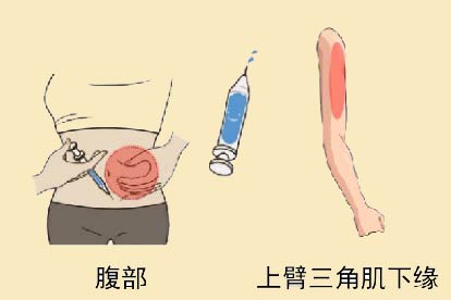 肝素钠注射部位图