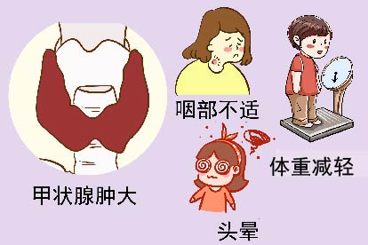 甲状腺肿大症状图