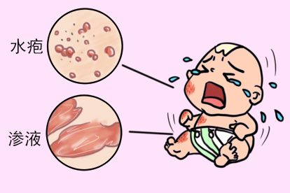 儿童过敏症状图片