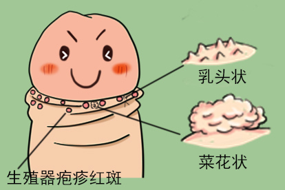 生殖器疱疹红斑图片