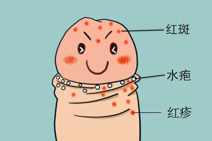15岁男孩生殖器上长红疙瘩图片