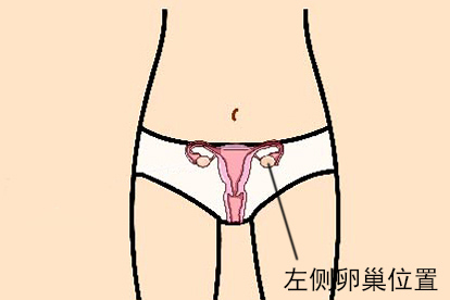 左侧卵巢位置图