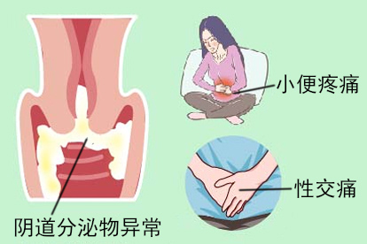 宫颈癌症状图