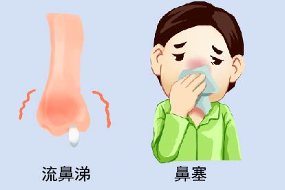 颌窦囊肿症状图