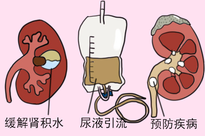 男性输尿管作用图