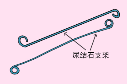 尿结石支架图片