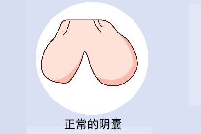 正常阴囊图片