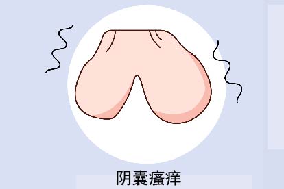 阴囊瘙痒图片