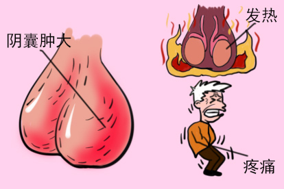 老人阴囊肿大图片