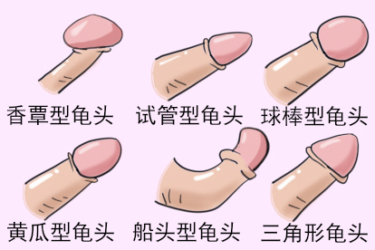 龟头六种形状图