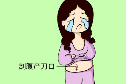 剖腹产刀口凹凸不平图片