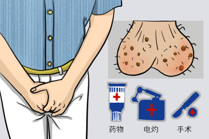 阴囊上褐色斑点图