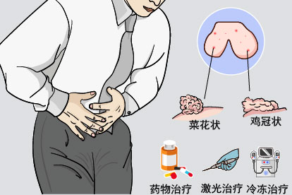阴囊尖锐湿尤症状图