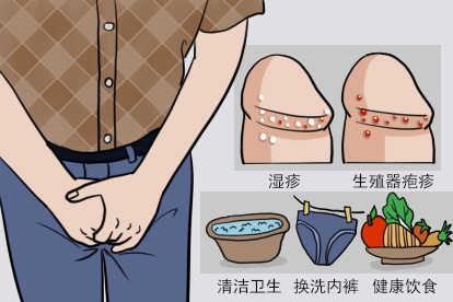 龟头私处小红点图